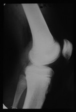 Magic Lantern Slide ROYAL FREE HOSPITAL LONDON XRAY NO32 C1950 VINTAGE PHOTO