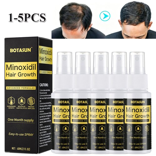 Minoxidil spray hair - minoxidil,