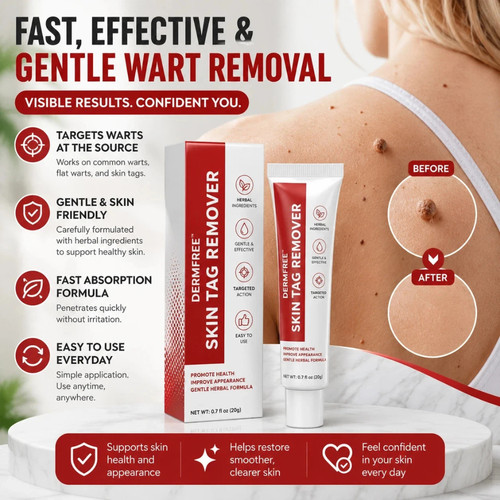 Natural skin tag remover cream - skin,