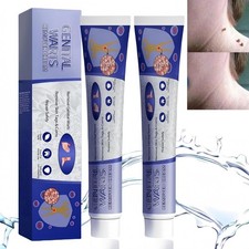 STRONG SKIN TAG REMOVER Cream NATURAL TREATMENT MOLES WARTS and TAGS