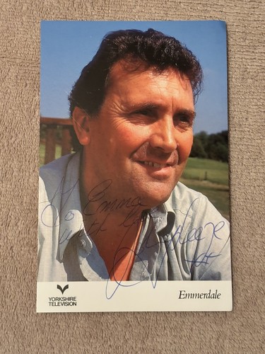 Johnny leeze hand - , (emmerdale)