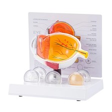 Anatomical Eyeball Model Teaching Tool Pathological Eyeball Anatomy Model