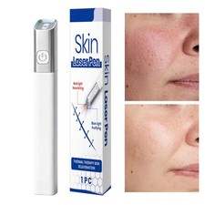 Skin Laser Pen Red And Blue