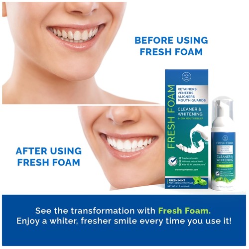 Aligner retainer cleaner - &,