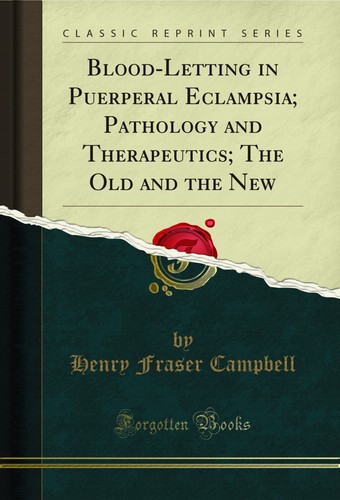 Blood letting puerperal - blood-letting, in