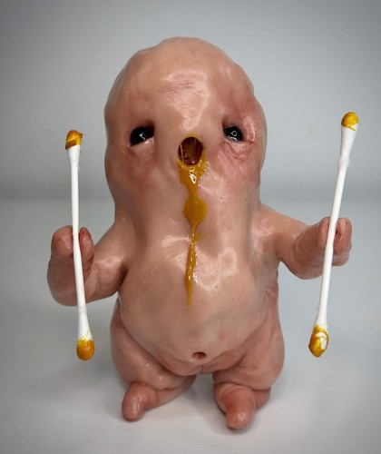 Ear wax disturbie - disturbie, –