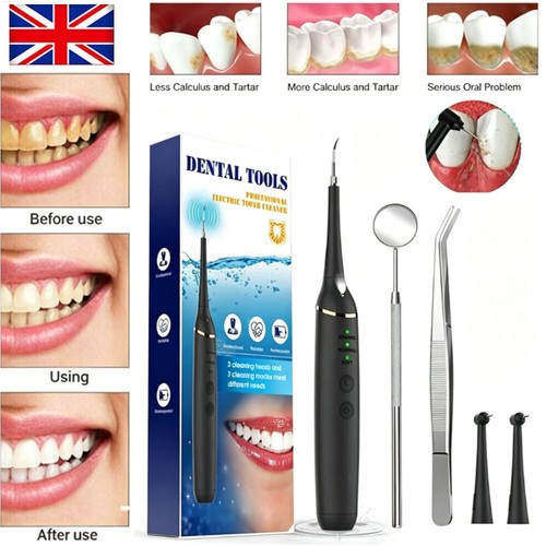 Electric ultrasonic tooth - ultrasonic,