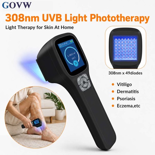 Handheld 308nm uvb - 308nm, therapy