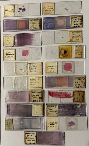 Vtg microscope slides - vtg, 1940s