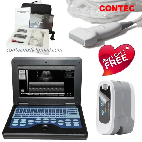 Cms600p2 portable ultrasound - cms600p2,