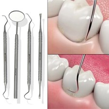 DENTAL TEETH CLEANING KIT