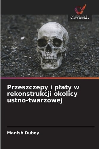 Przeszczepy platy w - przeszczepy,