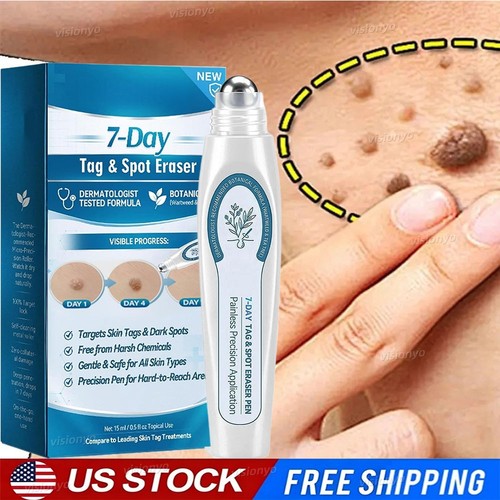 Day skin tag spot eraser - tag, &