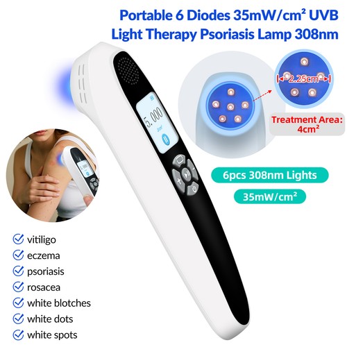 308nm narrowband uvb light - 308nm,