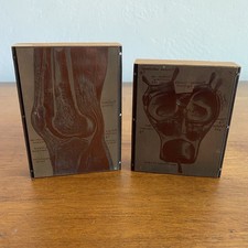 Antique Medical Copperplate
