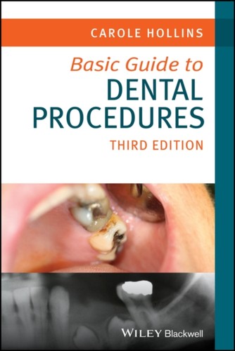 Basic guide dental - to,