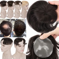 Mens Bald Spot Hair Loss