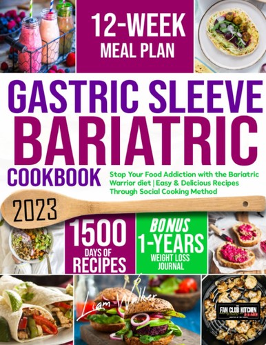 Gastric sleeve bariatric - gastric,