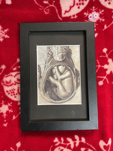 Rare art print framed medical - art, ,medical