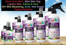 Skin Tag Remover, Wart, Black Dot Tag, Acne, Nail Fungal Treatment Pain Free UK