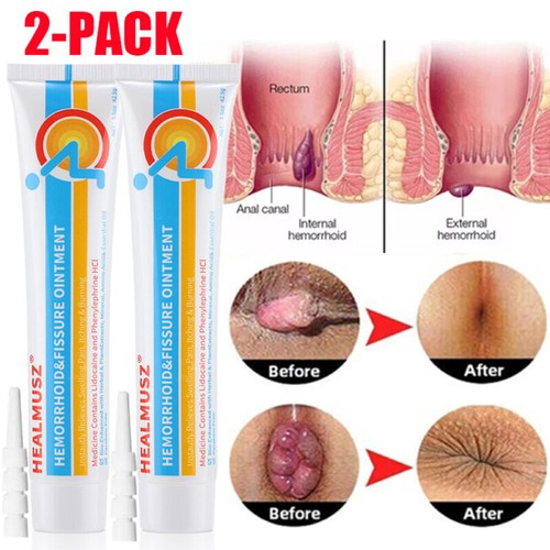 2pcs herbal hemorrhoid cream - 2pcs,