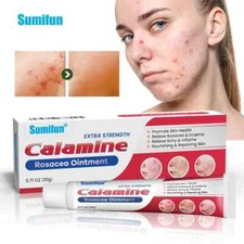 20g New Rosacea Ointment Treat