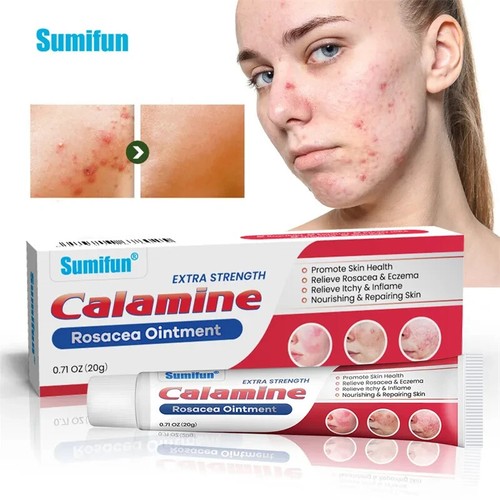 20g new rosacea - 20g, treat