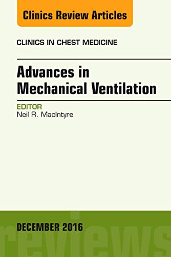 Advances mechanical - advances,