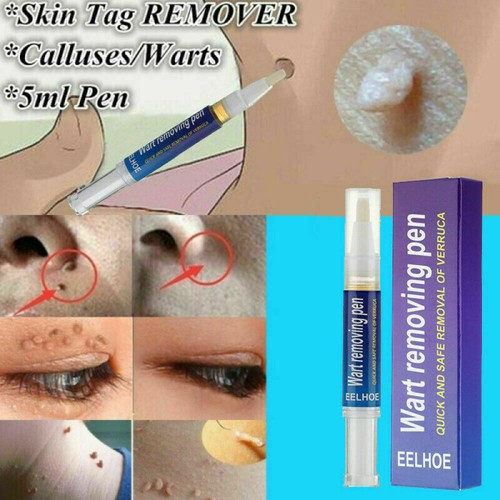Hours wart remover - 1/2/4x,