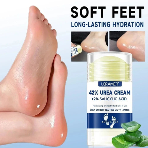 Urea foot cream - foot, +