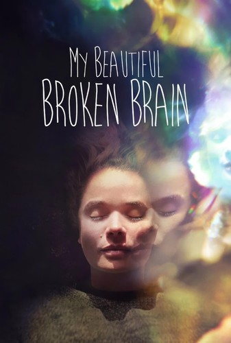 Beautiful broken brain - my,