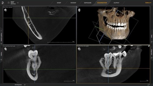 Dentsply sirona sidexis - sirona, 4.4