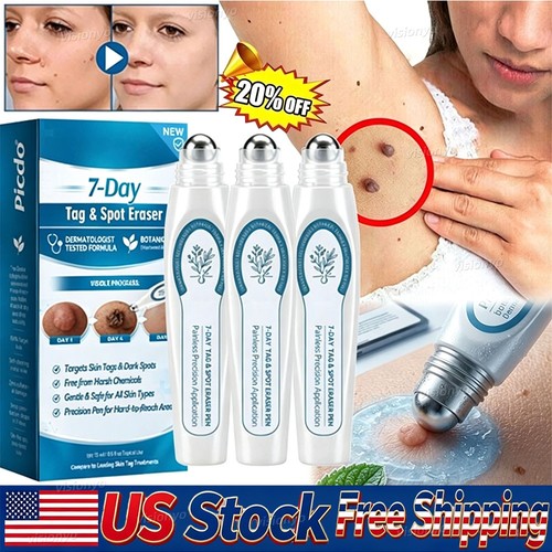 Skin tag remover painless - 3x,