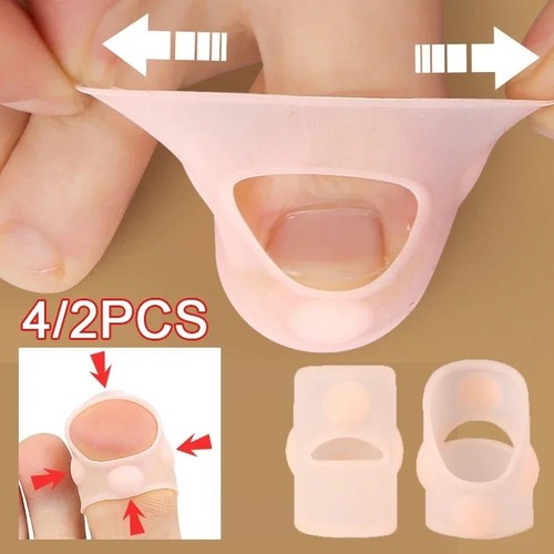 Silicone ingrown toenail - silicone,
