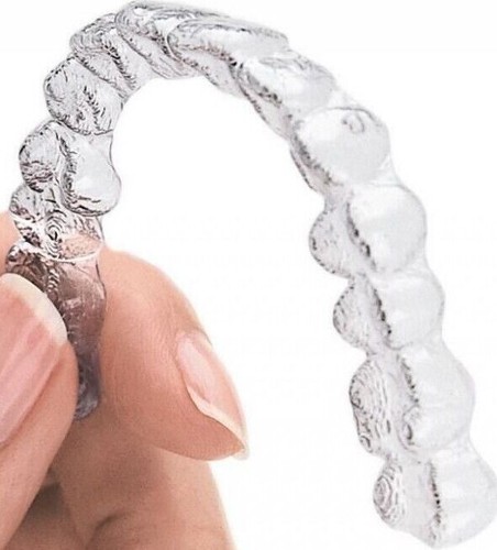 Custom fit dental orthodontic - custom,