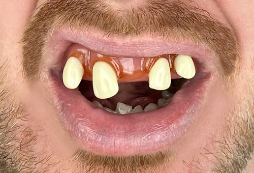 Billy bob tiger teeth every - tiger, teeth,