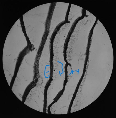 Microscope photo fungus - microscope, on