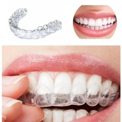 Teeth whitening mouth - 4,