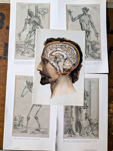 Anatomical medical print - medical,