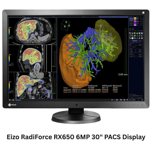 Eizo radiforce rx650 - radiforce, 30"