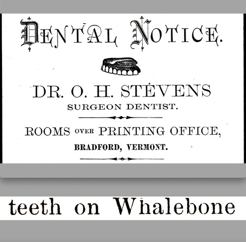 Teeth whale bone stevens - teeth,