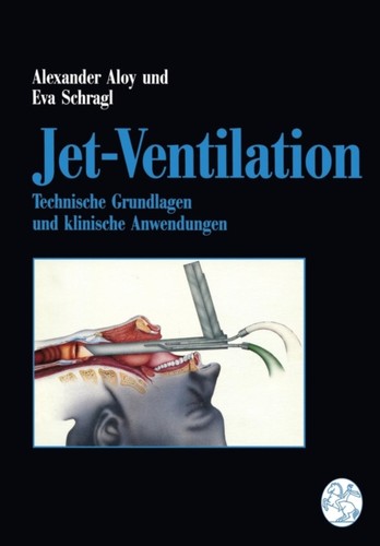 Aloy jet ventilation - aloy, jet-ventilation