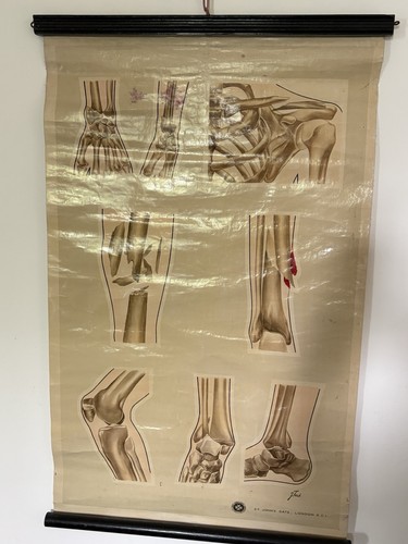 Vintage anatomical johns - vintage, st.johns