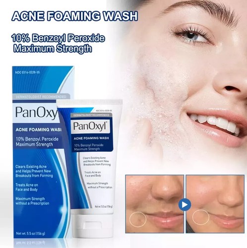 Acne foaming wash face - face, &