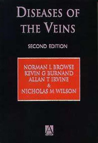 Diseases the veins - of,
