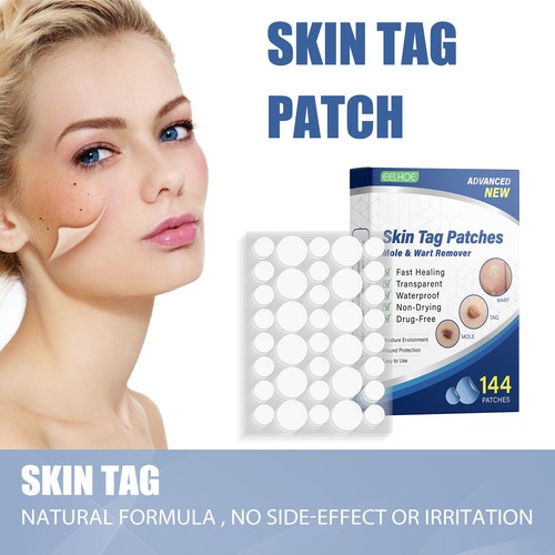 144pcs skin tag remover - 144pcs,