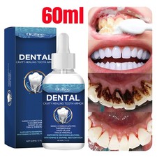60ml Tooth Care Solution