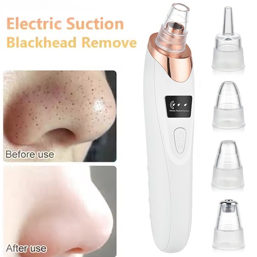 Electric blackhead remover - electric,