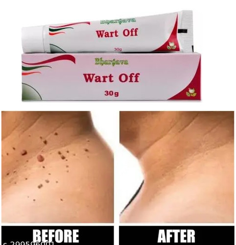 Fast and natural wart remover - fast,