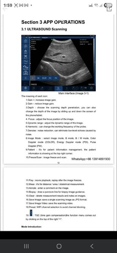 Portable smartwand ultrasound - portable,